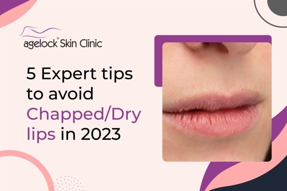 5 Expert tips to avoid chapped/dry lips in 2023