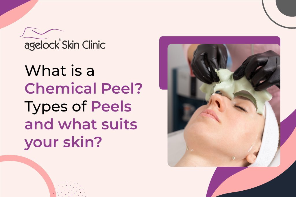 Types of Peels and what suits your skin What is a Chemical Peel? Types of Peels and what suits your skin?