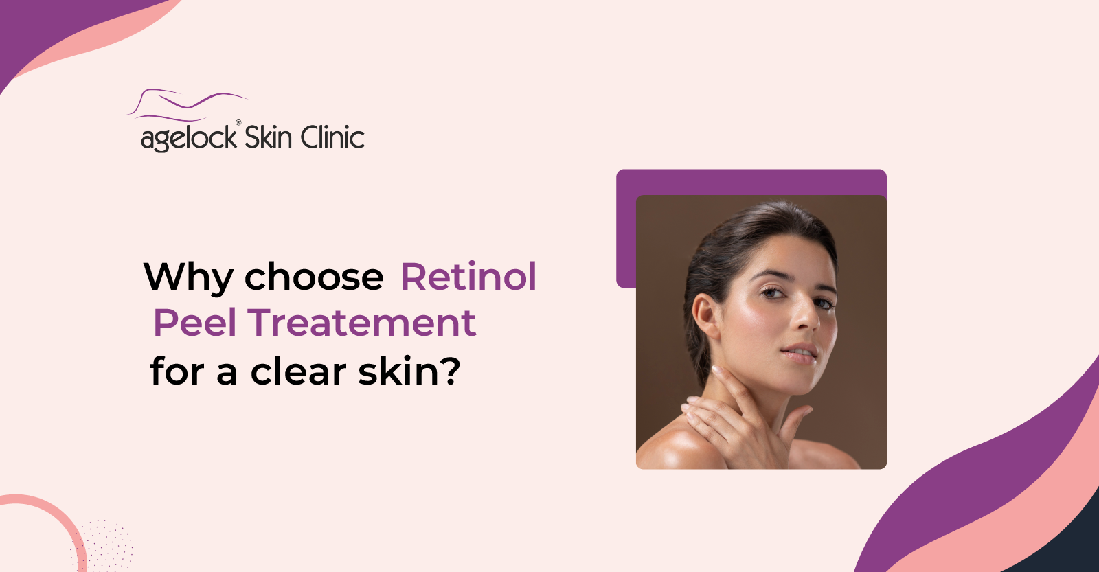 Why choose Retinol Peel Treatment for a clear skin?