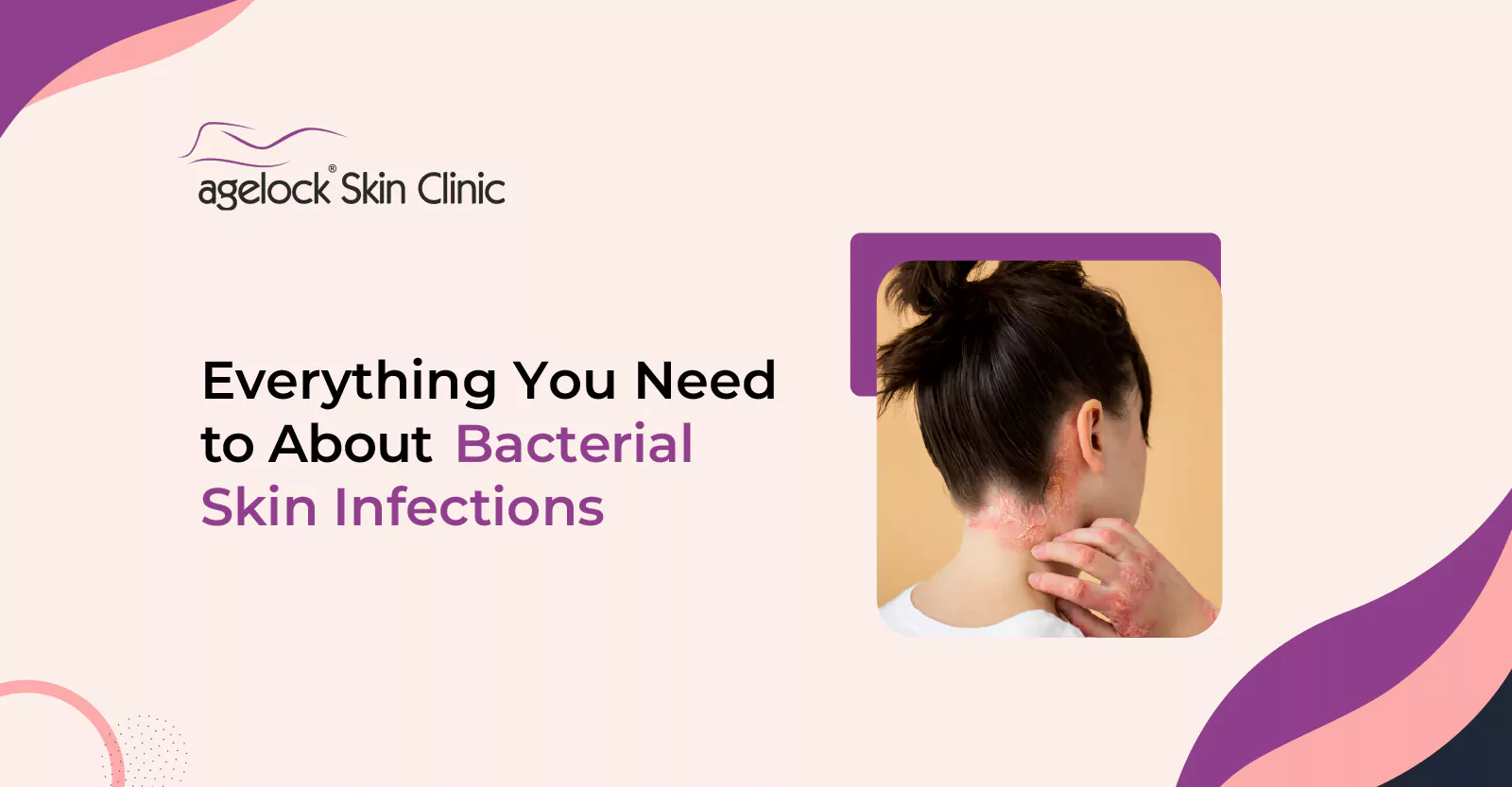 Everything You Need to About Bacterial Skin Infections