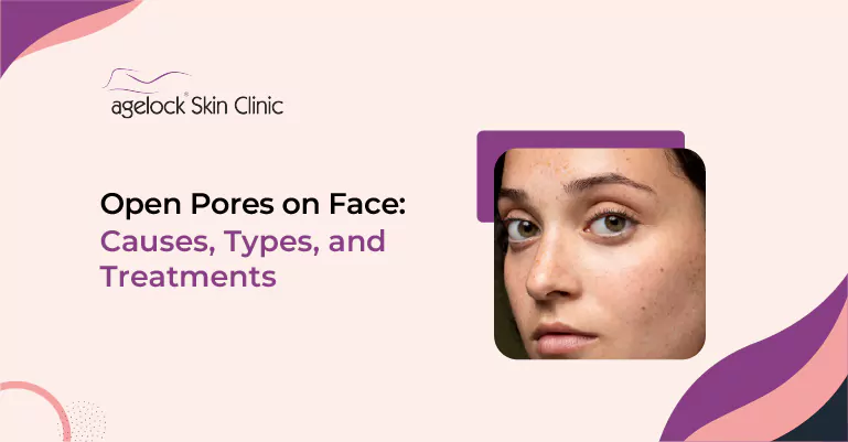 open-pores-on-face-mob