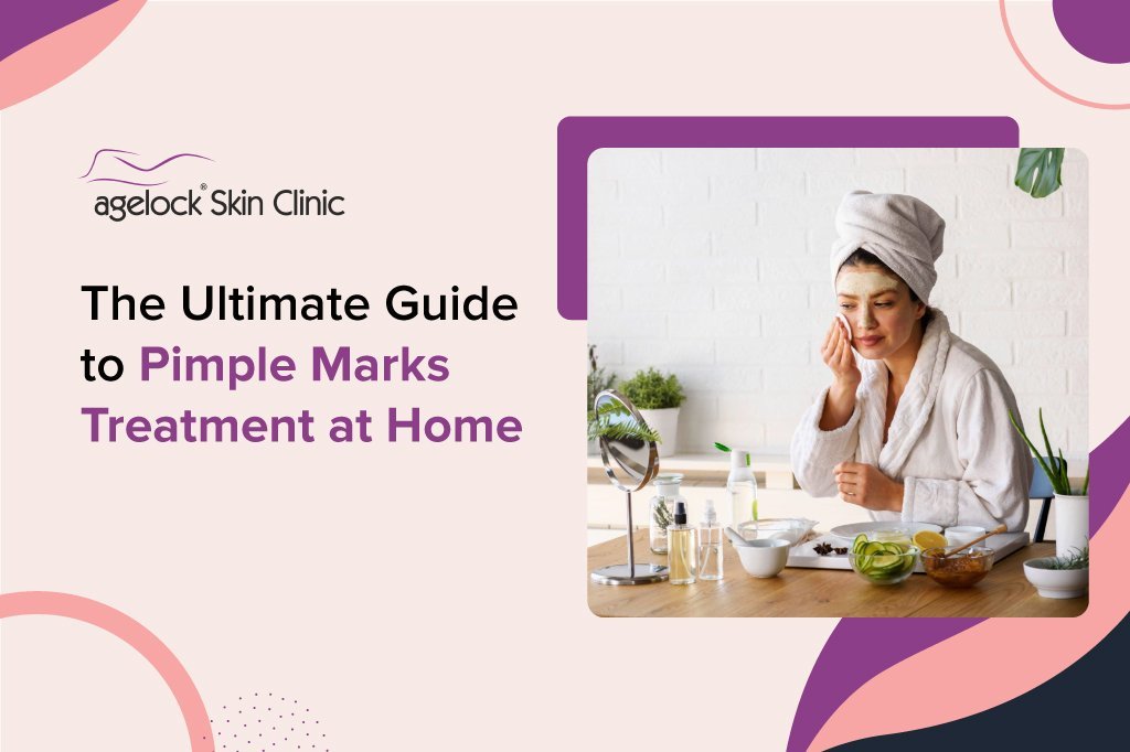 The-Ultimate-Guide-to-Pimple-Marks-Treatment-at-Home m The Ultimate Guide to Pimple Marks Treatment at Home