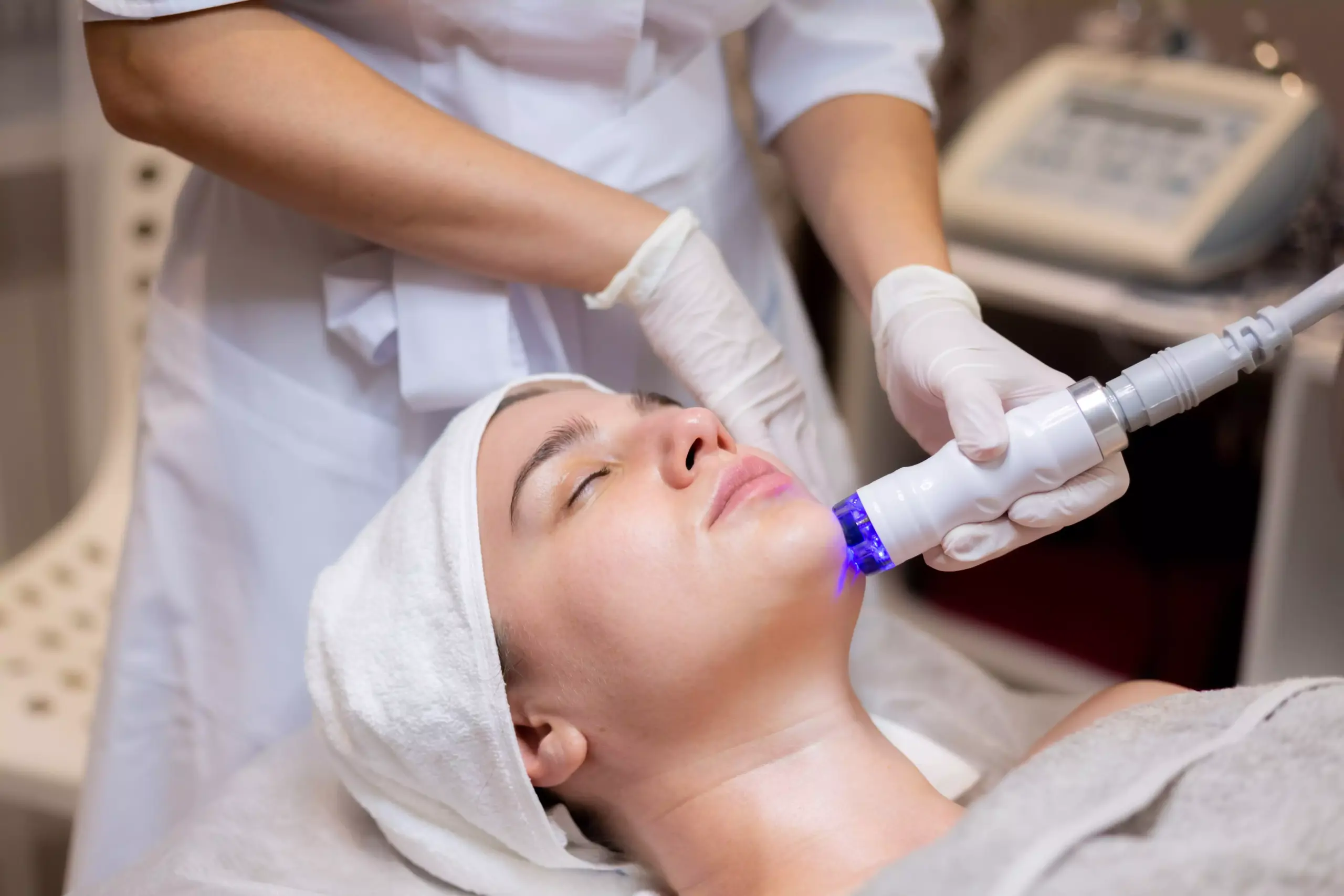MNRF skin treatment for acne scars at Agelock