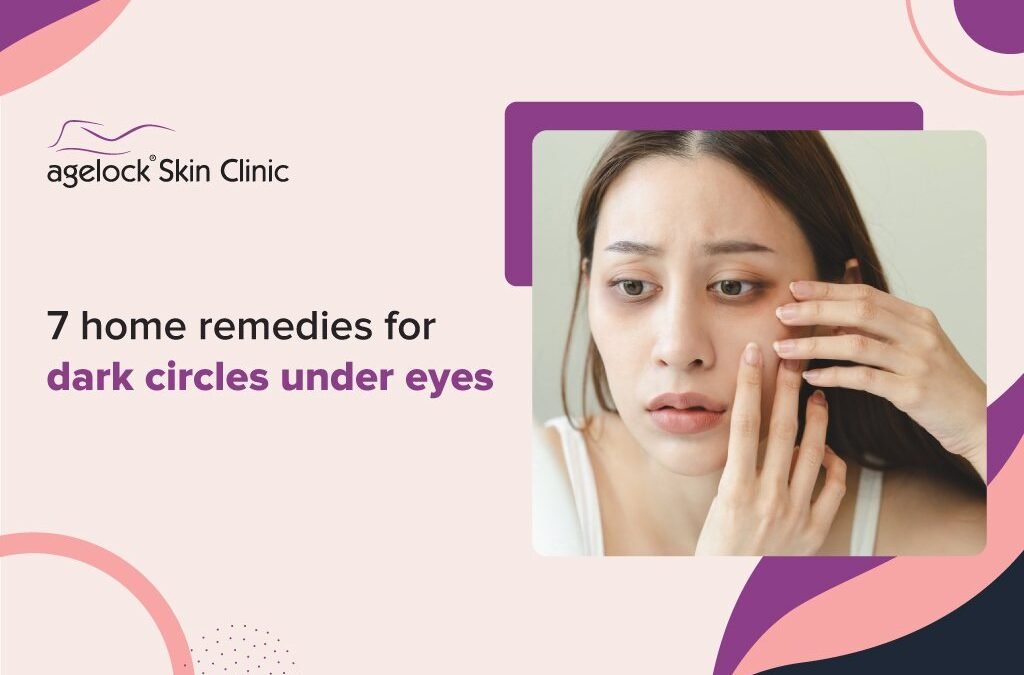7 home remedies for dark circles under eyes