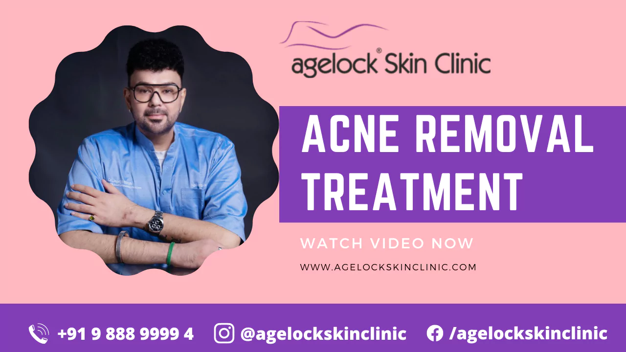 Treatment Videos
