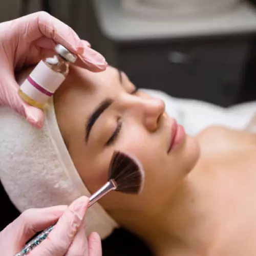 Chemical Peels Treatment