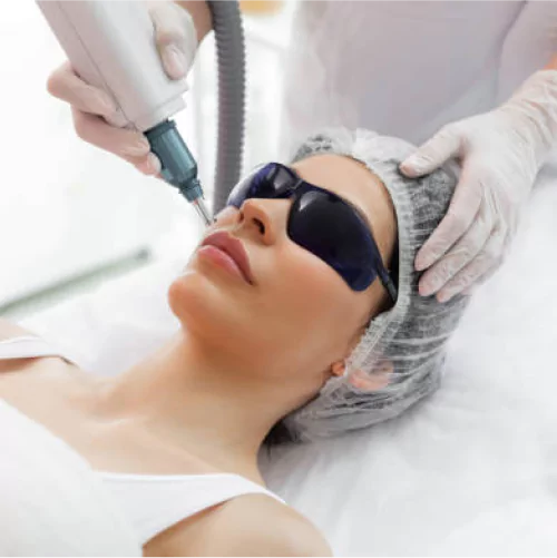 Cosmetic Laser Treatment