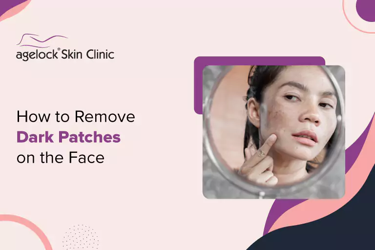How to Remove Dark Patches on the Face