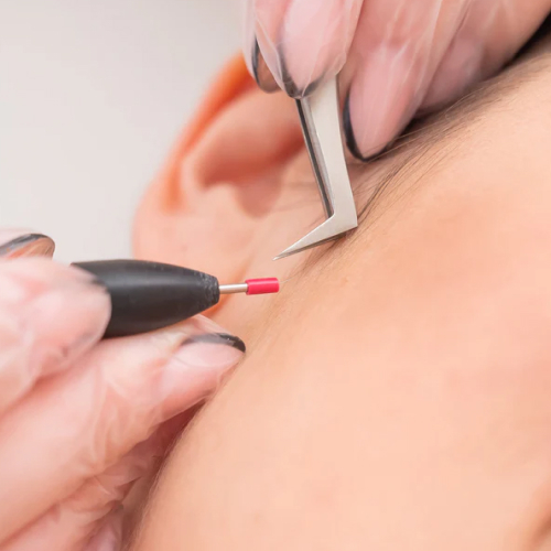 Electrolysis