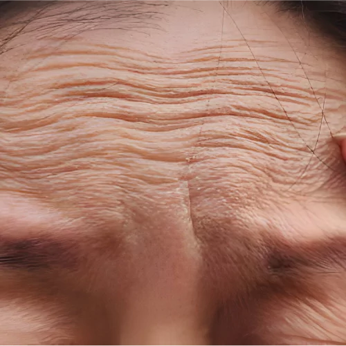 Forehead