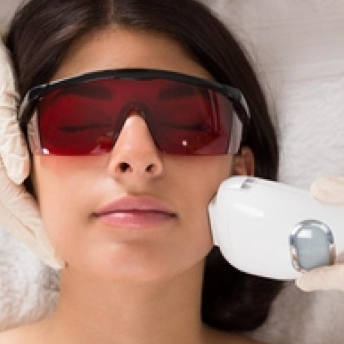 Intense Pulsed Light (IPL) Therapy