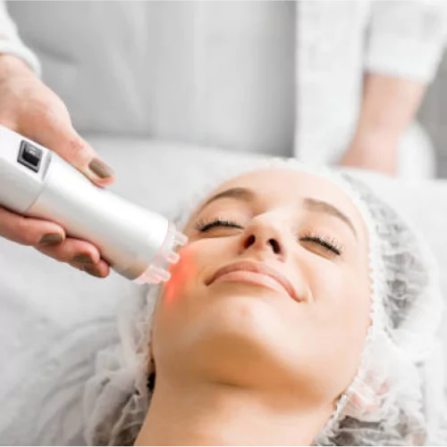 Laser Treatment for Face