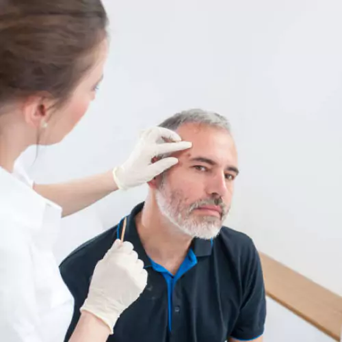 Lentigines skin Treatment