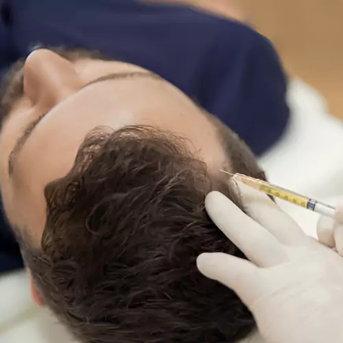Mesotherapy Treatment
