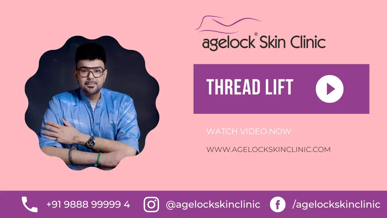 thread-lift Treatment Videos