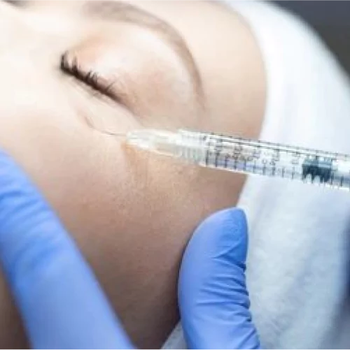 Under Eye Filler treatment at Agelock