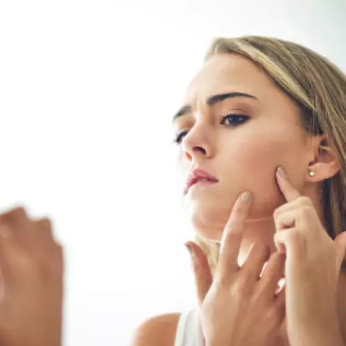 White Spot Removal Treatment