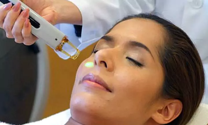 Laser toning procedure for hyperpigmentation at Agelock