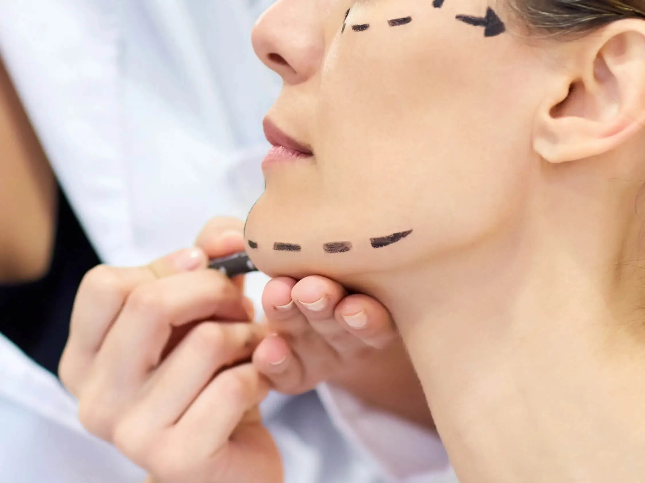 Thread lift techniques at Agelock