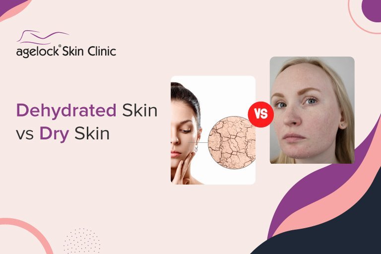 Dehydrated Skin vs Dry Skin