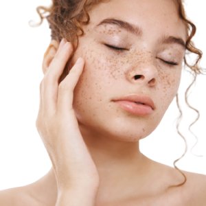 Meline peel treatment at Agelock