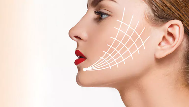 Face thread lift treatment at Agelock