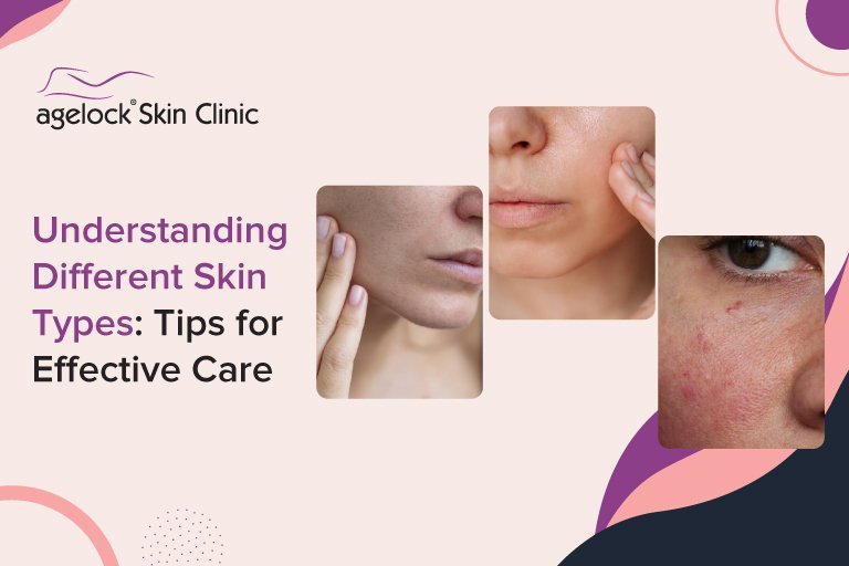 Understanding Different Skin Types: Tips for Effective Care