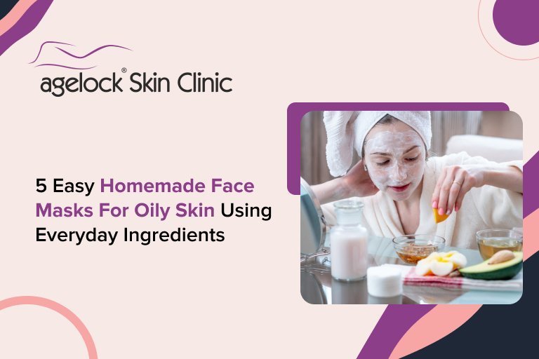 5 Easy Homemade Face Masks for Oily Skin Using Everyday Ingredients