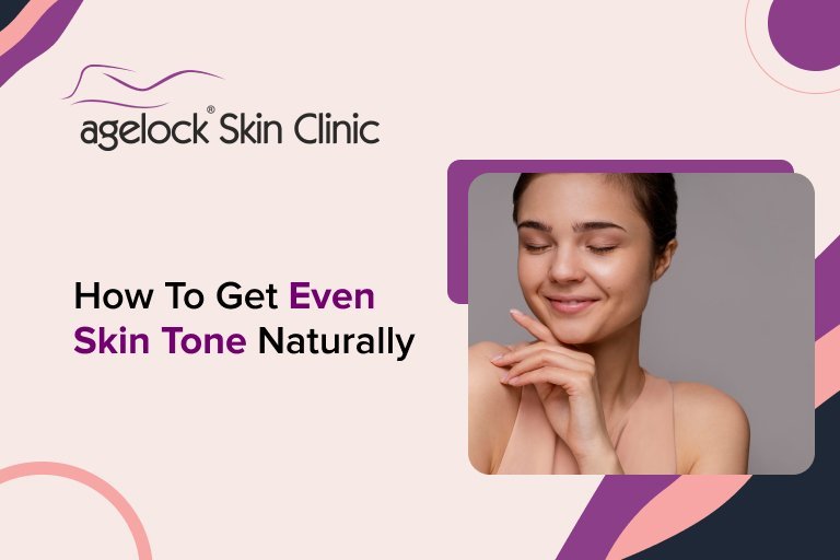 How to Get Even Skin Tone Naturally