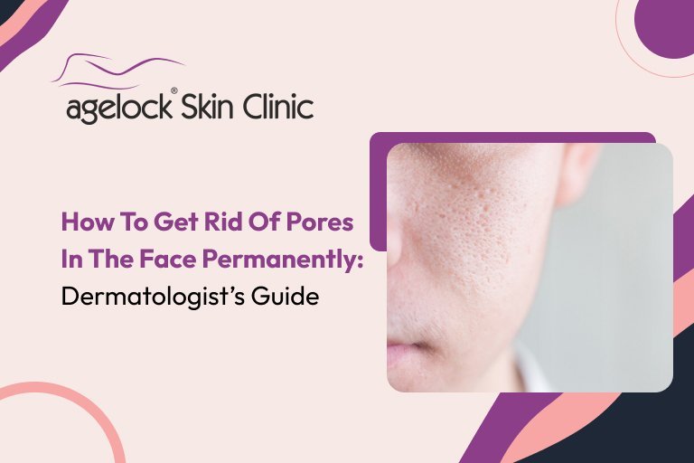 How To Get Rid Of Pores In The Face Permanently: Dermatologist’s Guide