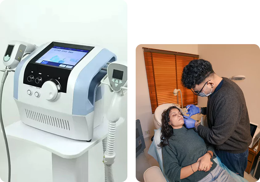 about EXILIS ULTRA 360
