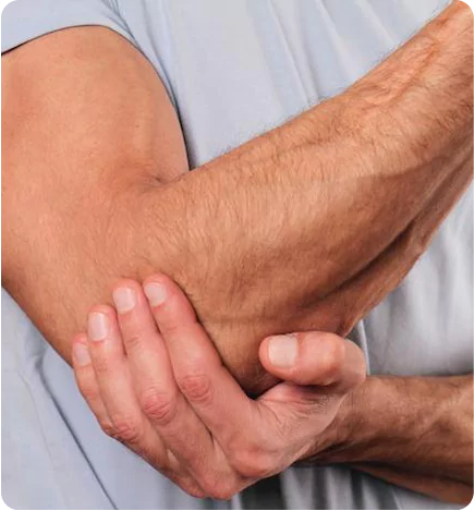 Arms and Elbows