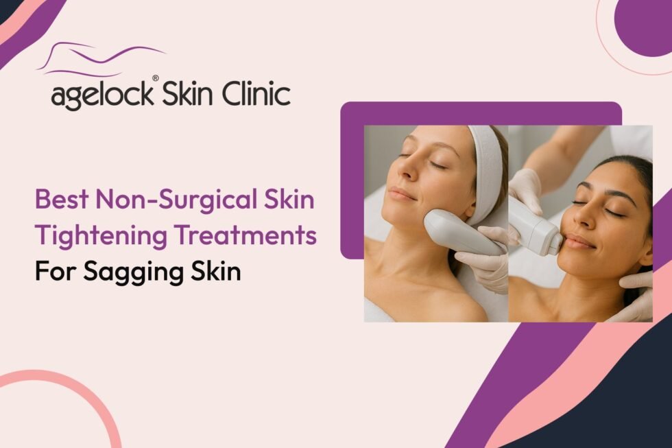 Best Non-Surgical Skin Tightening Treatments for Sagging Skin