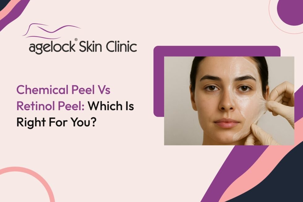 Chemical Peel vs Retinol Peel: Which Is Right for You?