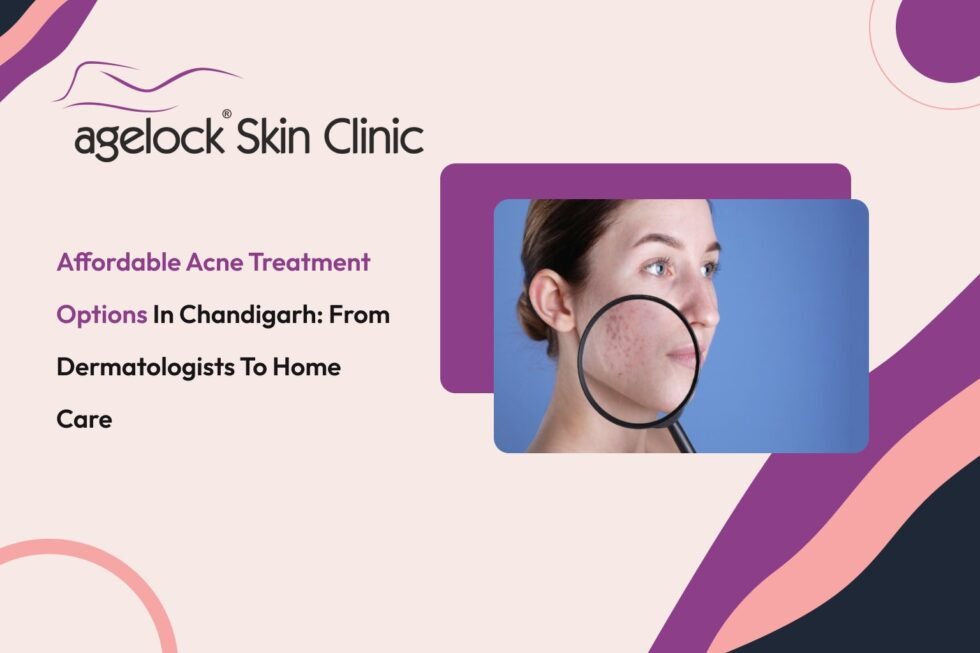 Affordable Acne Treatment Options in Chandigarh: From Dermatologists to Home Care