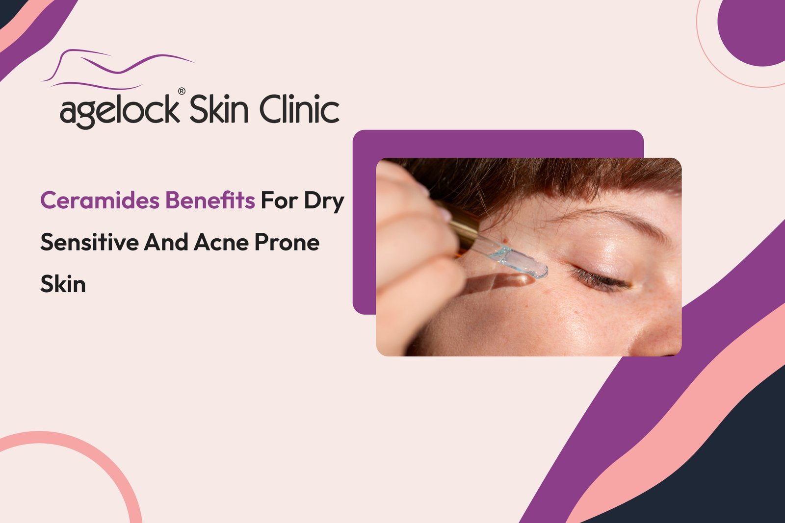 Ceramides benefits for dry sensitive and acne prone skin
