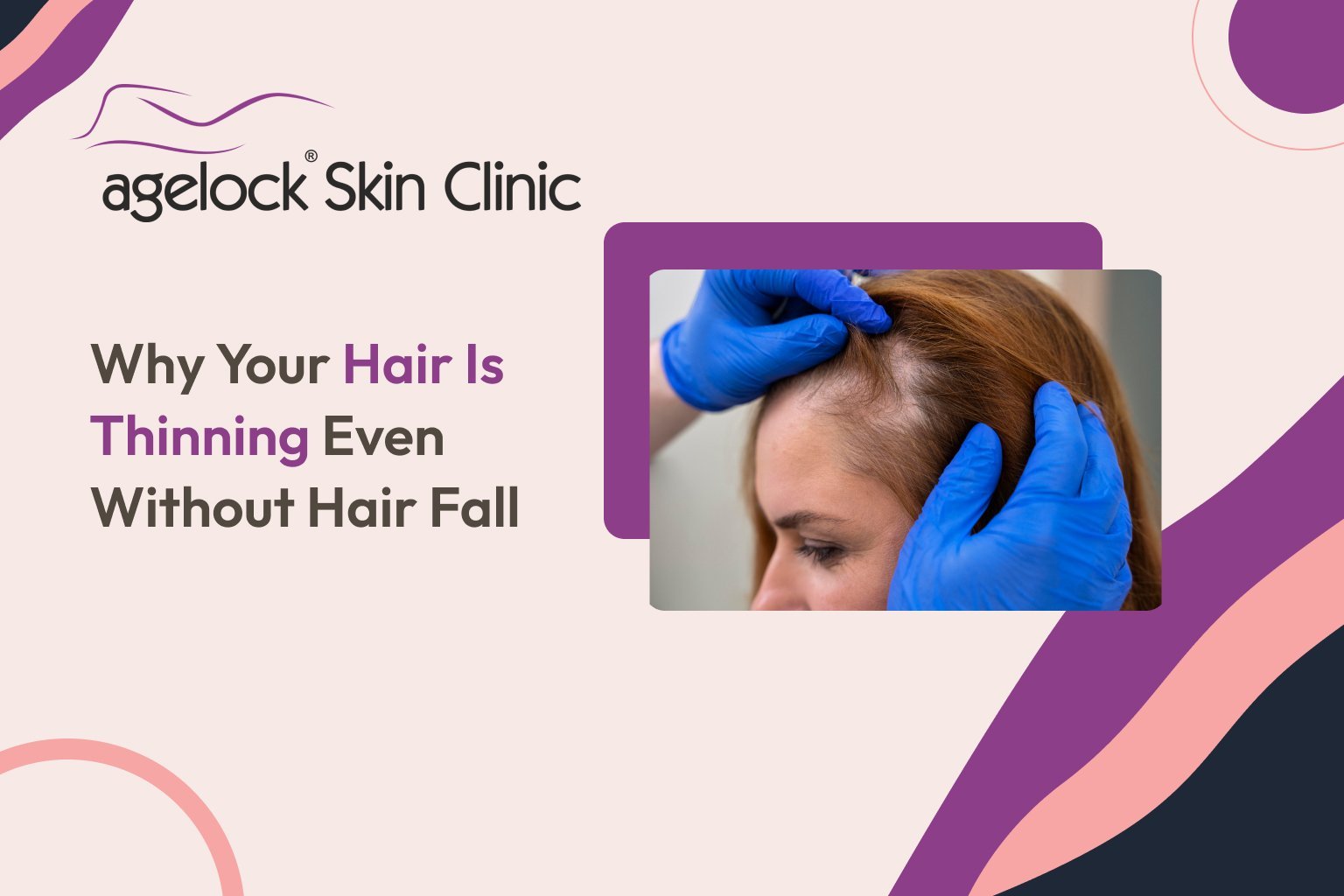 Why Your Hair Is Thinning Even Without Hair Fall