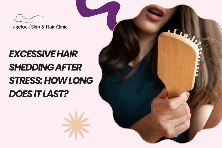 Excessive Hair Shedding After Stress: How Long Does It Last?