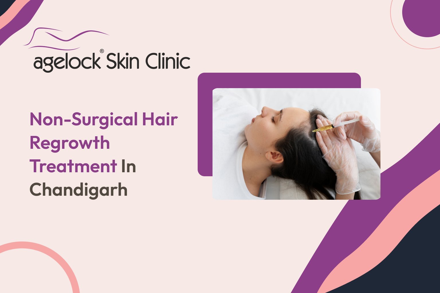 Non-Surgical Hair Regrowth Treatment in Chandigarh