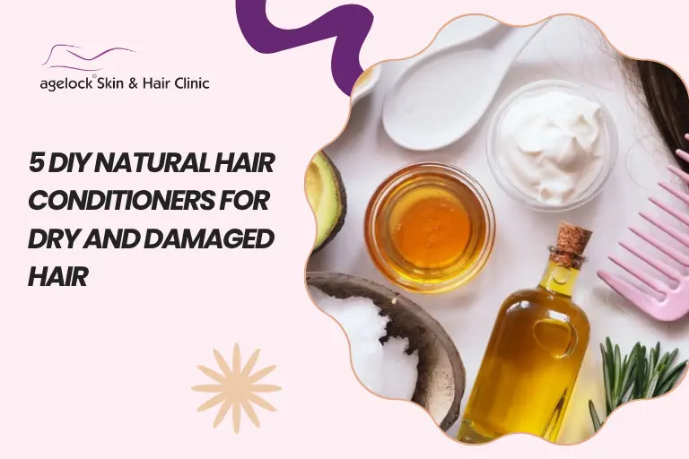 5 DIY Natural Hair Conditioners for Dry and Damaged Hair