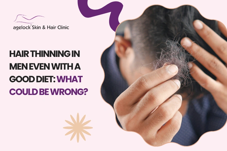 Hair Thinning in Men Even With a Good Diet: What Could Be Wrong?