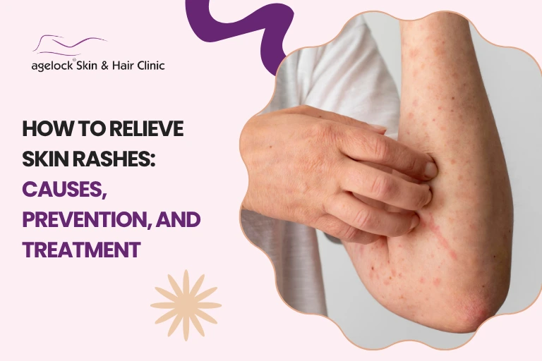 How to Relieve Skin Rashes: Causes, Prevention, and Treatment