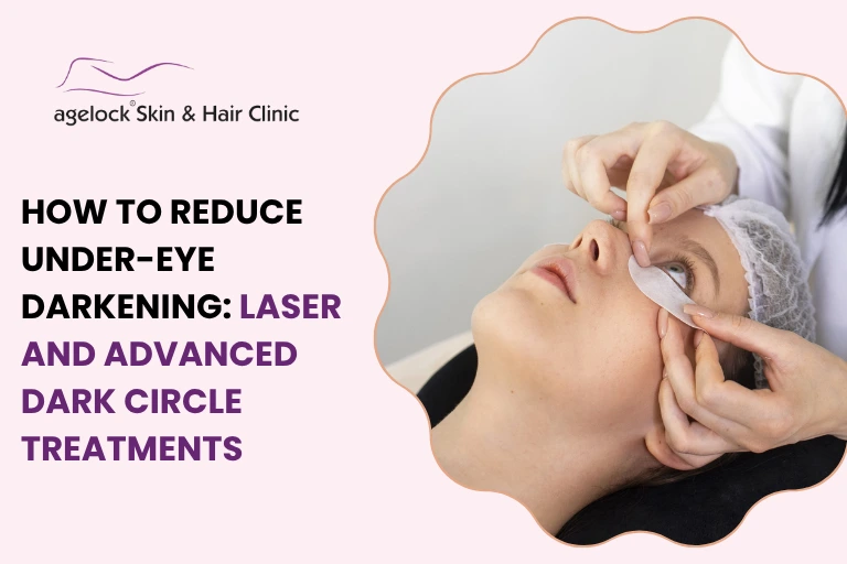 How to Reduce Under-Eye Darkening: Laser and Advanced Dark Circle Treatments