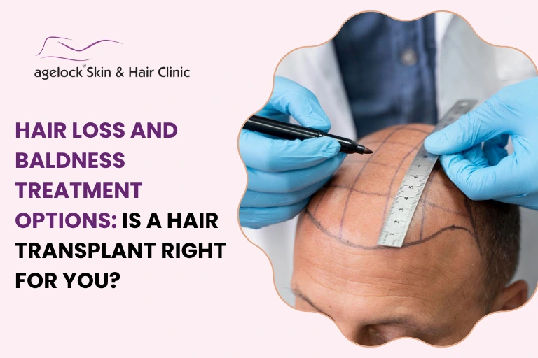 Hair Loss and Baldness Treatment Options: Is a Hair Transplant Right for You?
