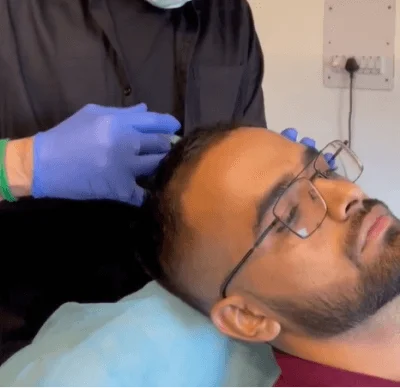 Hairloss Treatment treatment at Agelock