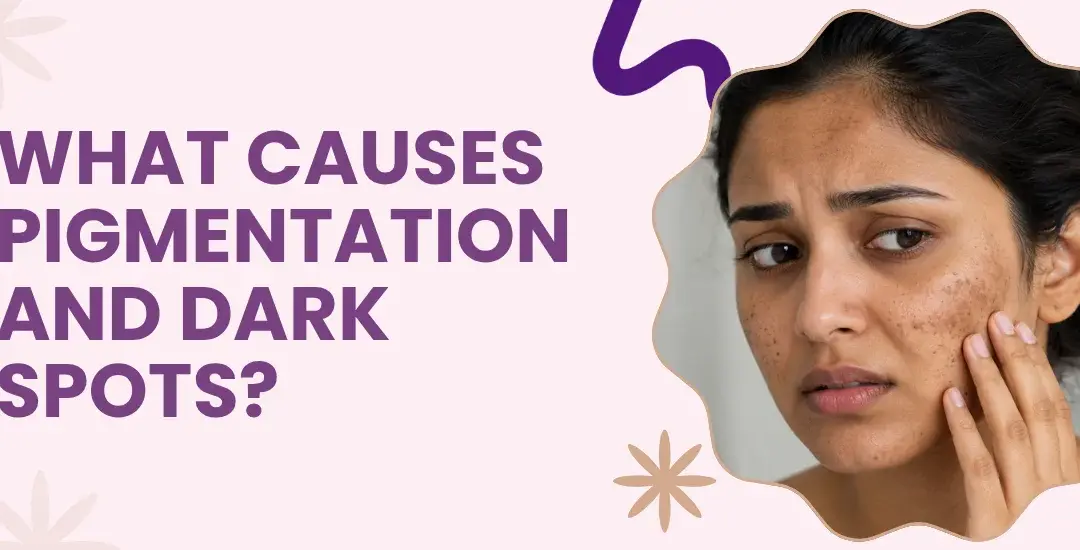 What Causes Pigmentation and Dark Spots?