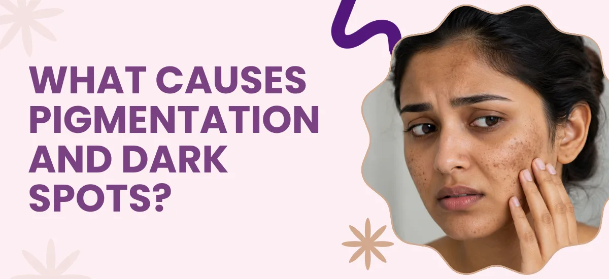 What Causes Pigmentation and Dark Spots?