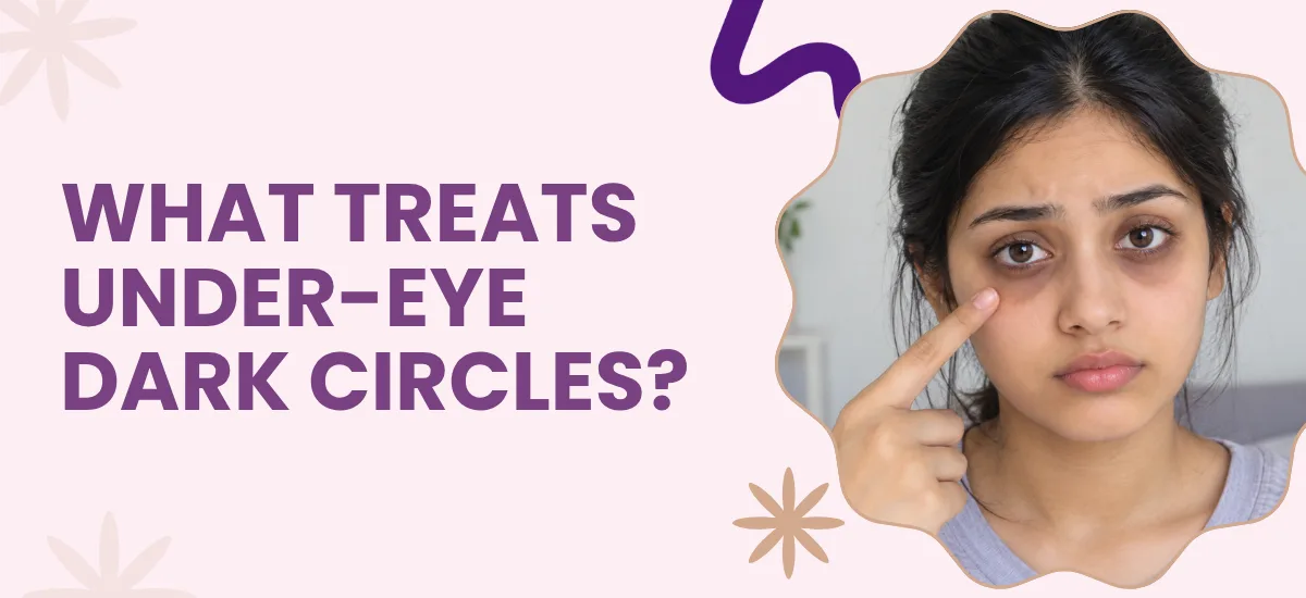 What Treats Under-Eye Dark Circles?